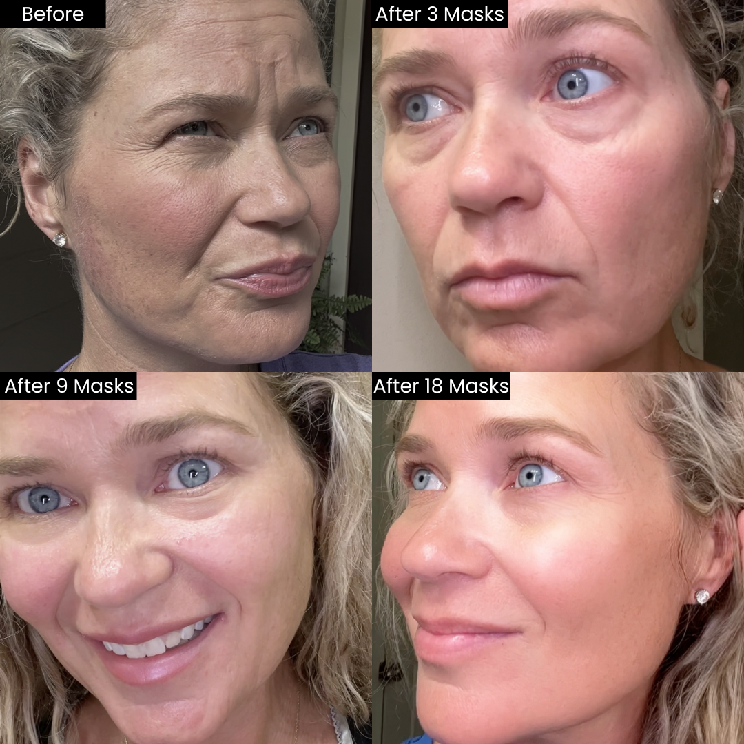 LuminiSkin™ – Anti-Aging &amp; Natural Radiance Collagen Face Mask