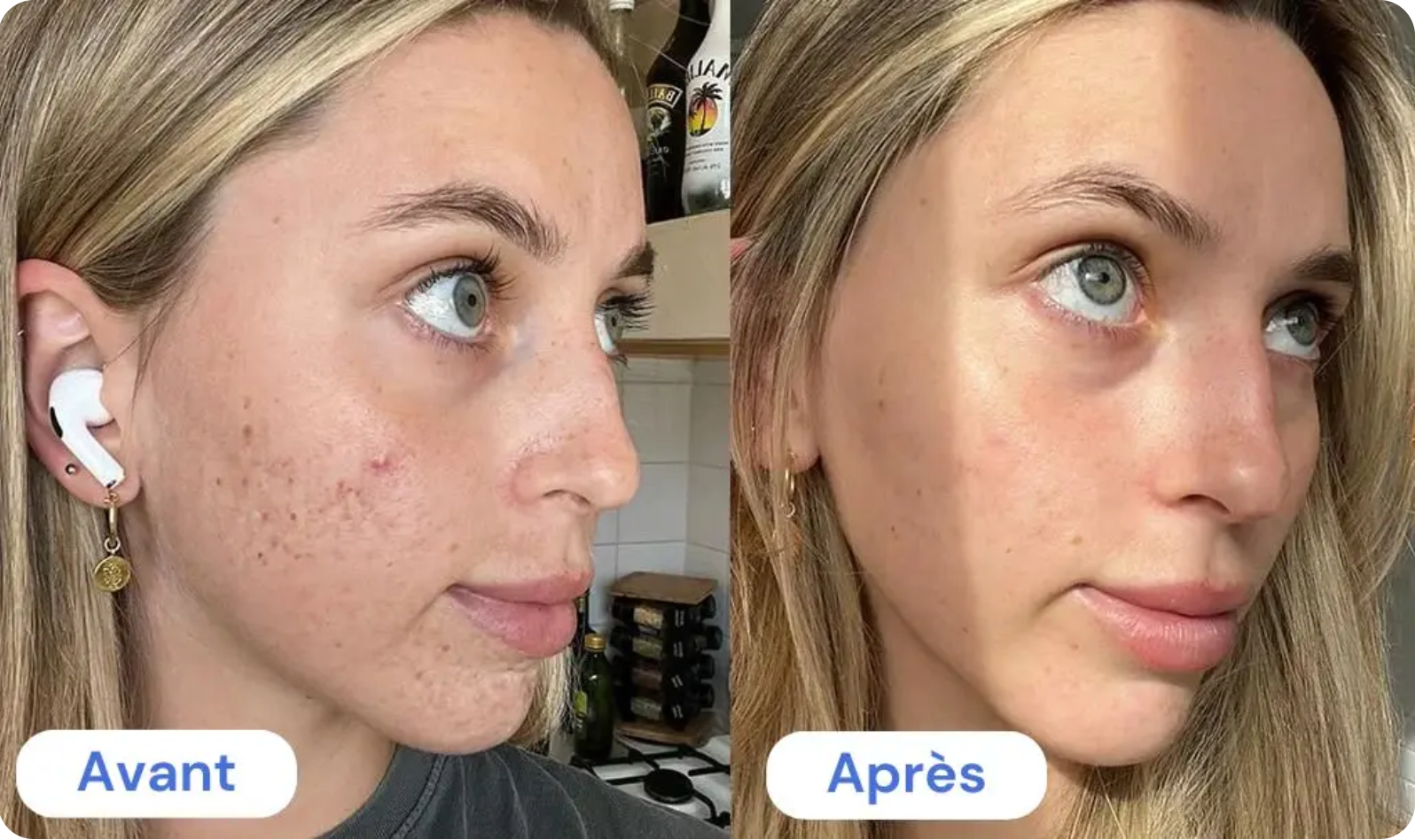 LumiSkin™ – Masque Visage Collagène Anti-Âge & Éclat Naturel - Luminiskin