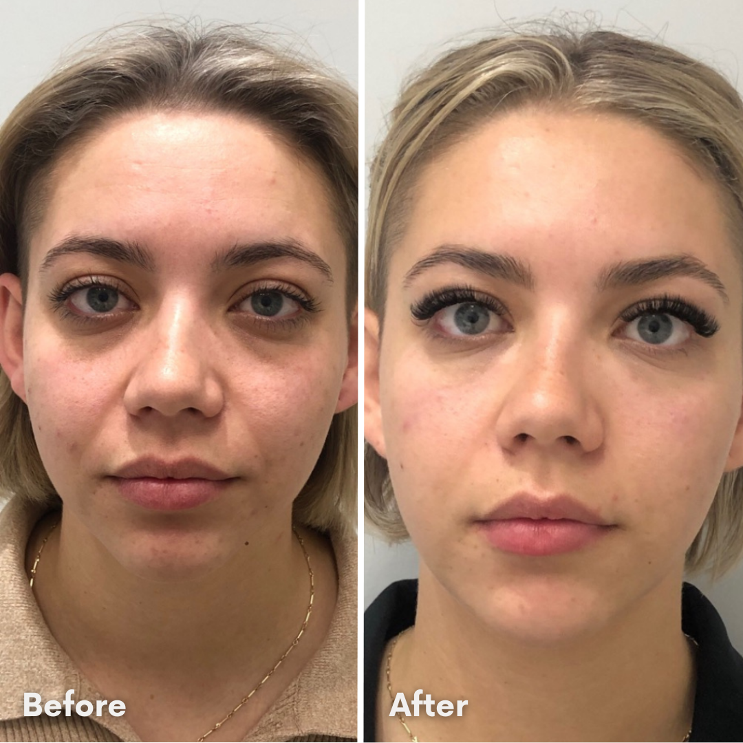 LuminiSkin™ – Anti-Aging &amp; Natural Radiance Collagen Face Mask