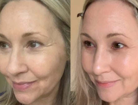 LuminiSkin™ – Anti-Aging &amp; Natural Radiance Collagen Face Mask