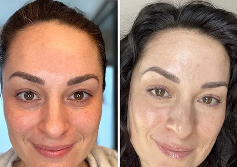 LuminiSkin™ – Anti-Aging &amp; Natural Radiance Collagen Face Mask