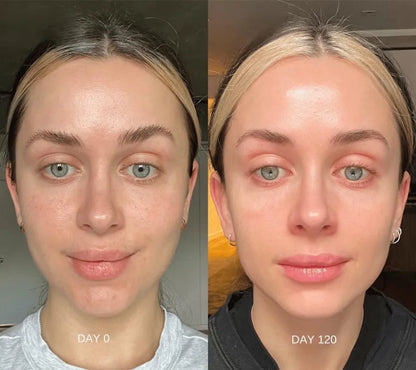 LumiSkin™ – Masque Visage Collagène Anti-Âge & Éclat Naturel - Luminiskin